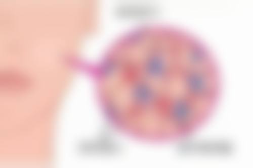 韩国ROOT整形外科李愚炅医生擅长项目
