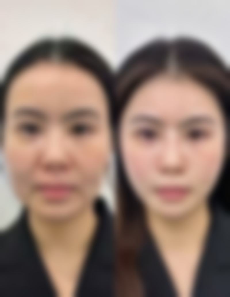 韩国newman男科医院口碑评价