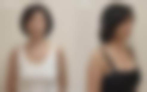 广州华美医疗美容整形医院口碑评价