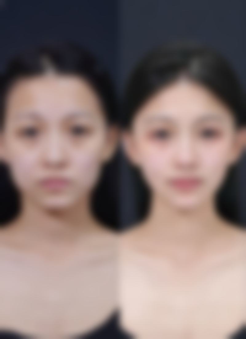 武汉华夏整形医院医疗美容科擅长项目。