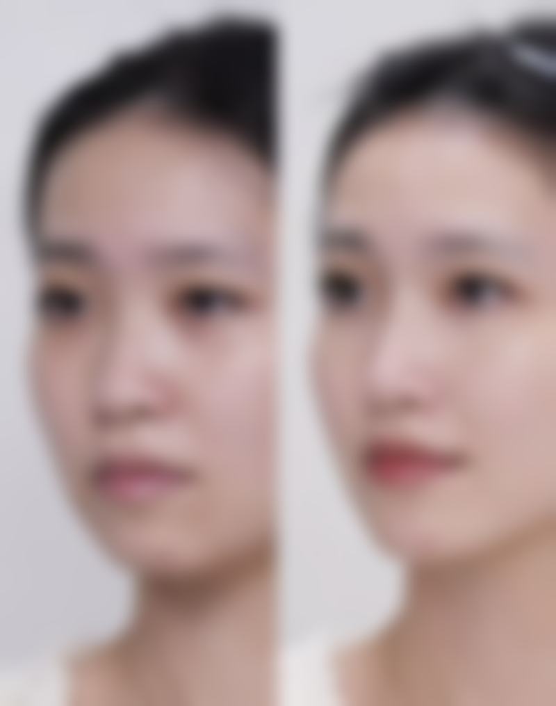张魁医生坐诊的苏州爱思特整形医院