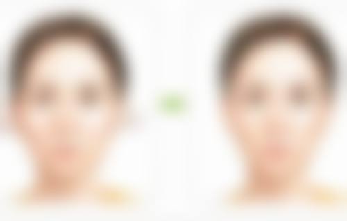 北京惠美整形医院医生团队经验稳定。