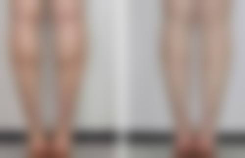 福州乐肤源医疗美容门诊部预约挂号方式。