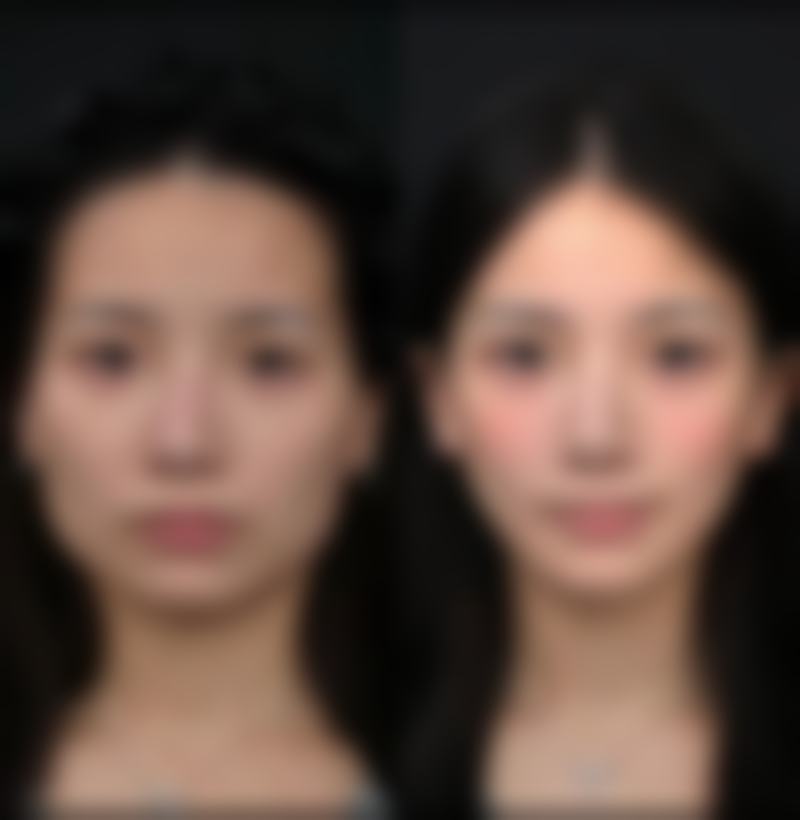 南京奇美医疗美容门诊部擅长项目
