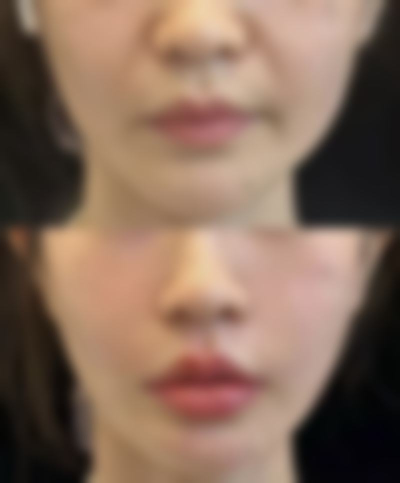 东莞浩然医疗美容门诊部治疗反馈与口碑评价。