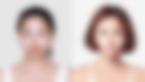 韩国延世ELLEFIN医院韩荣浩医生上班时间:每天上午九点 - 下午六点