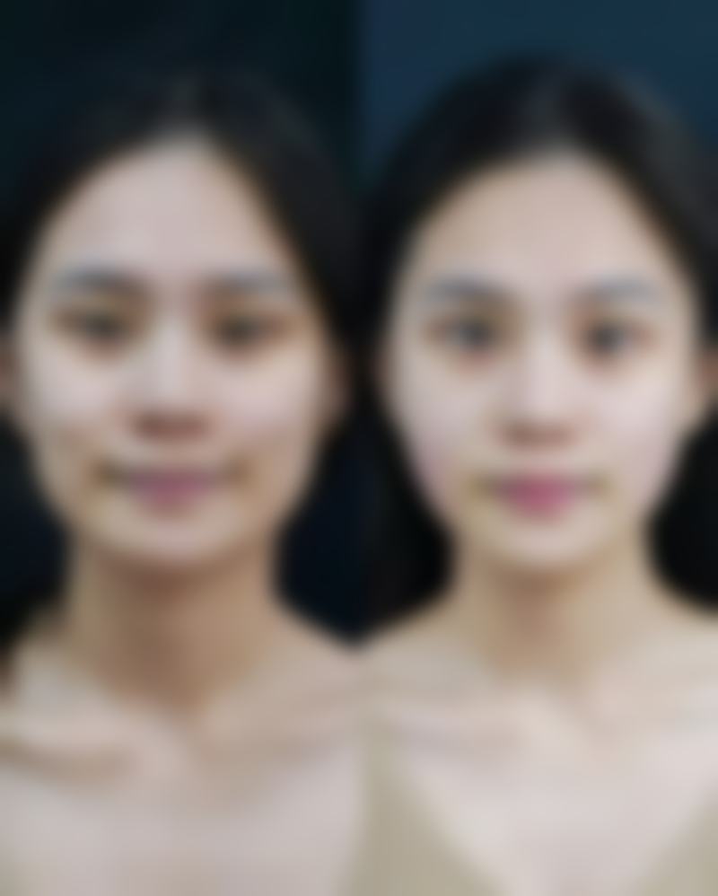 深圳心悦整形医疗美容门诊部医生团队经验稳定。