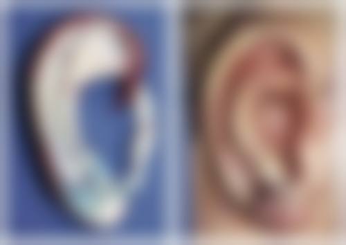 长沙上美医疗美容门诊部治疗反馈与口碑评价。