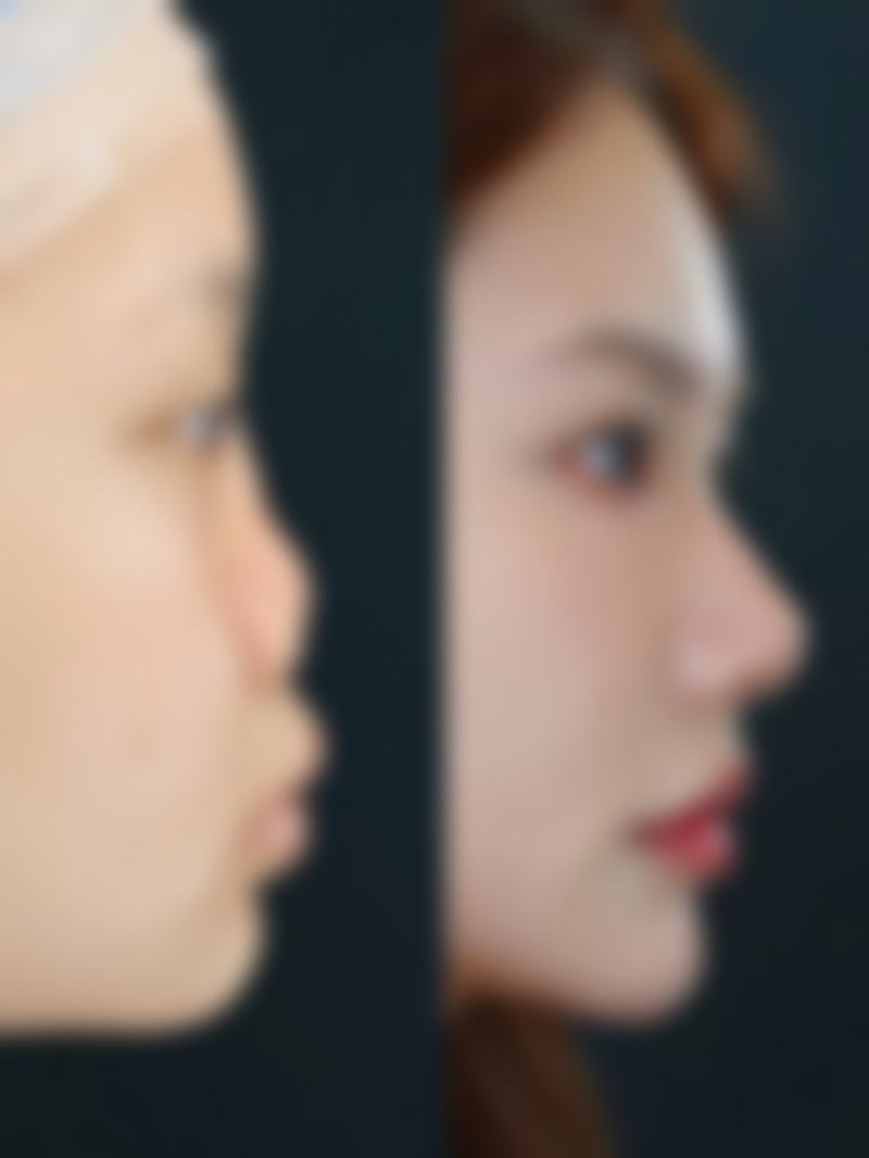 十堰吉美医学美容诊所擅长项目。