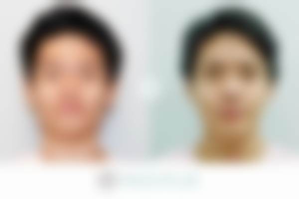 韩国faceplus整形外科项目预约及价格说明