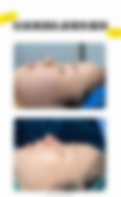 李懋的整形技术兼顾安心与美学属性