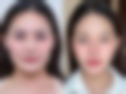 杨惠敏擅长的核心诊疗项目解析