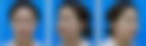 谭臻田擅长多类整形美容项目