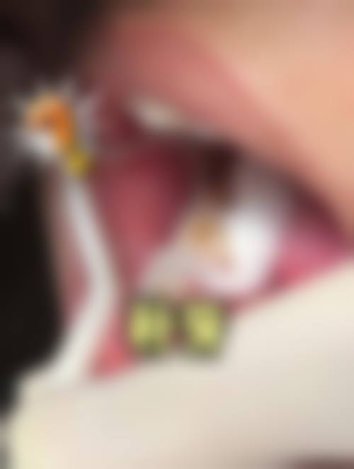 如何便捷预约李正恩医生号源