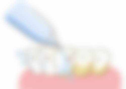 李子龙诊疗技术与临床特色优势