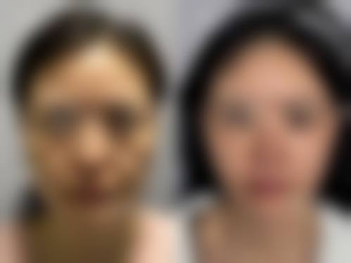 李鸿鹏医生差异化诊疗技术与优势分析