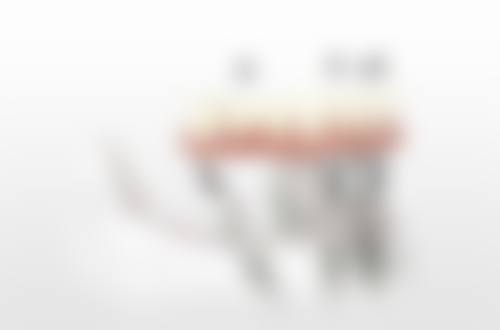 戴文君采用数字化精细诊疗技术体系